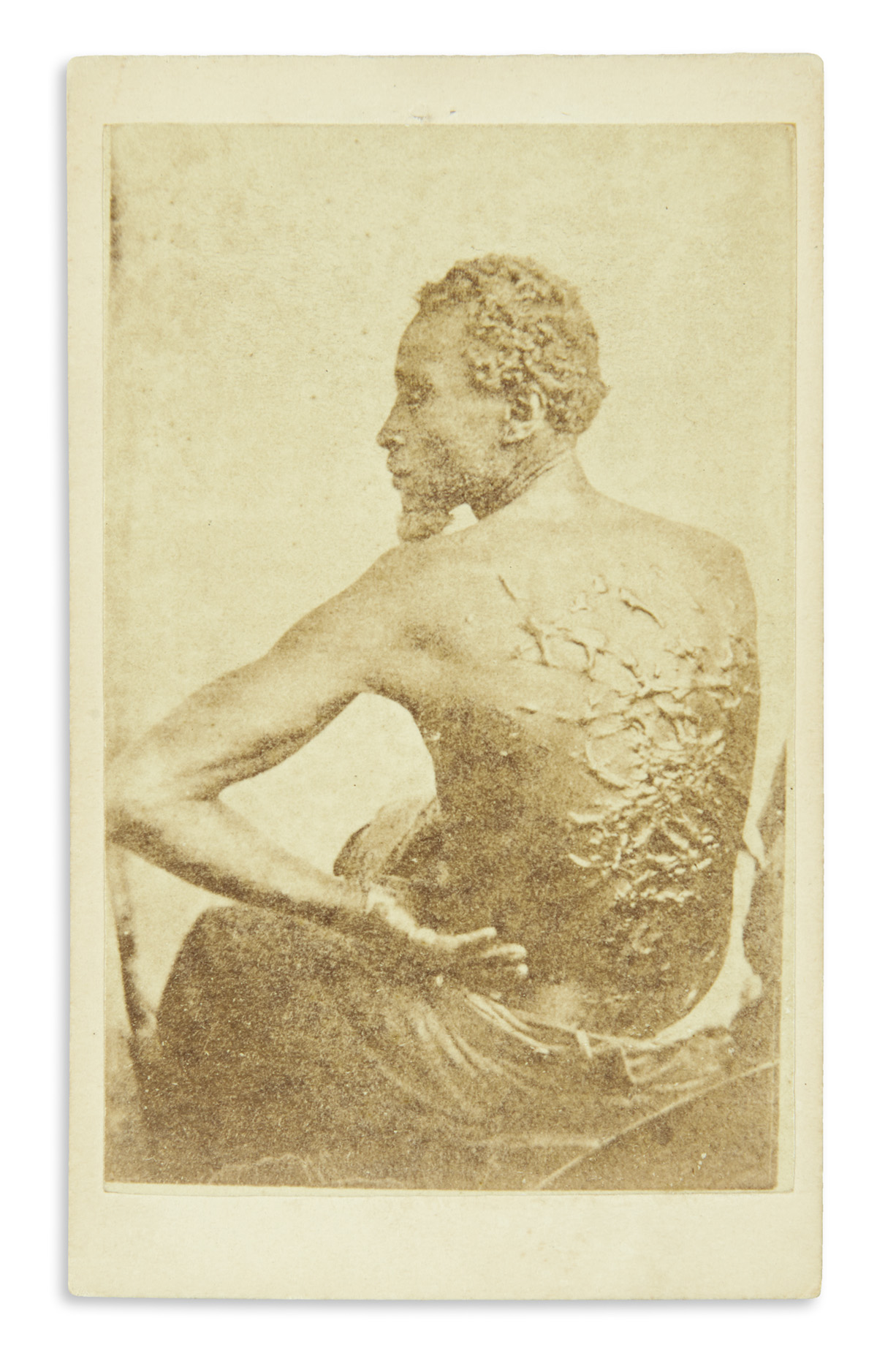 (SLAVERY AND ABOLITION.) [McPherson & Oliver; photographers.] The Scourged Back.